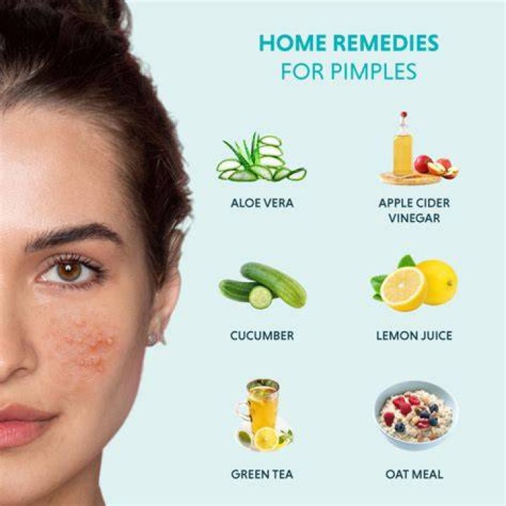 Can ginger cure pimples?
