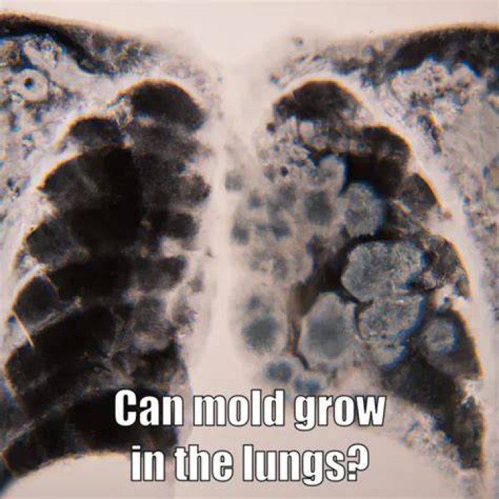 Can mould grow in your lungs?
