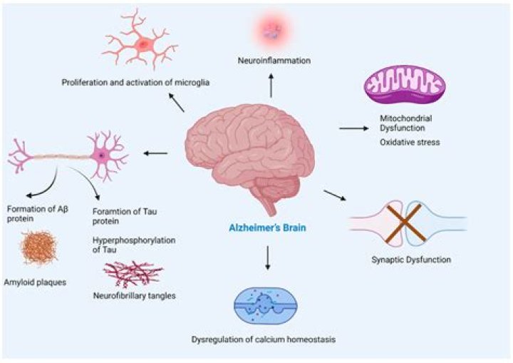 Can plaque in the brain be reversed?