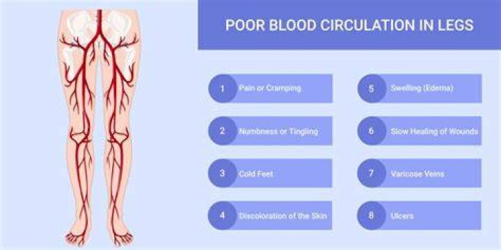 Can poor circulation cause leg pain?