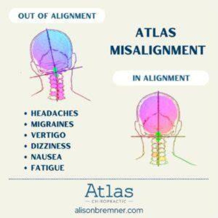 Can spinal misalignment cause vision problems?