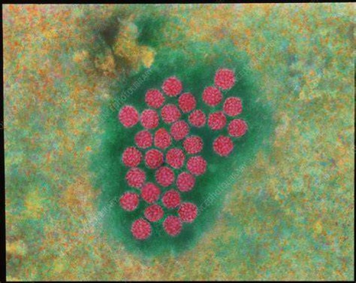 Can wart virus live on fabric?