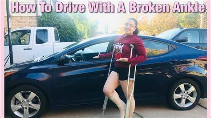 Can you drive with a broken ankle?