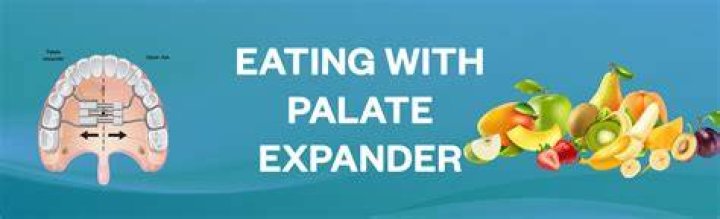 Can you eat pizza with an expander?