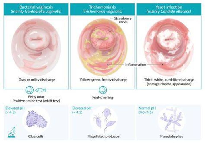 Can you get a false positive trichomonas?