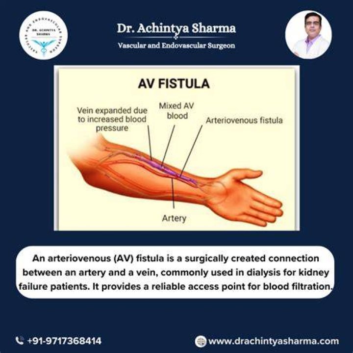 Can you just live with a fistula?