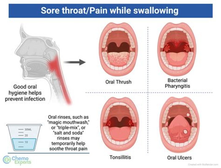 Do you get sore throat with thyroid?