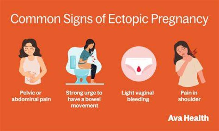 Do you have constant pain with ectopic pregnancy?