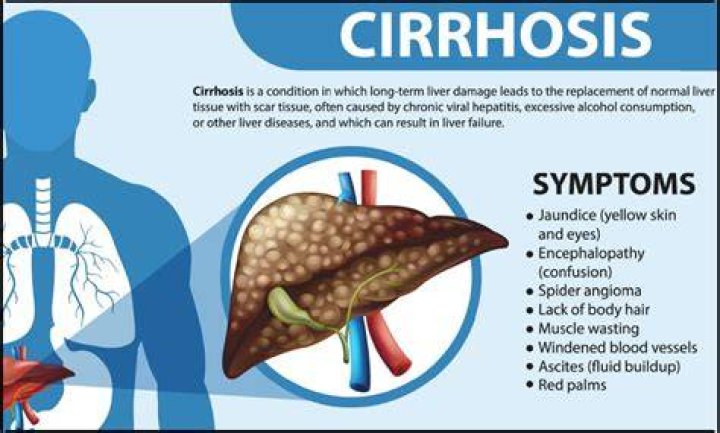 Does cirrhosis cause high triglycerides?