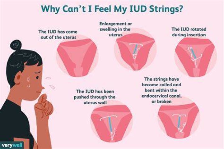 Does copper IUD make periods worse?