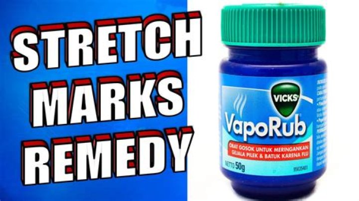 Does Vicks remove stretchmarks?
