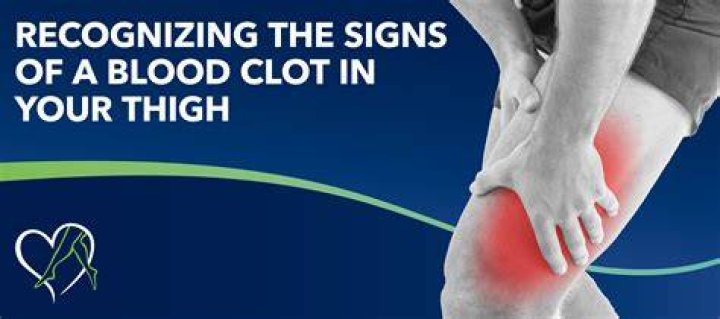 How can I tell if I have a blood clot in my leg?