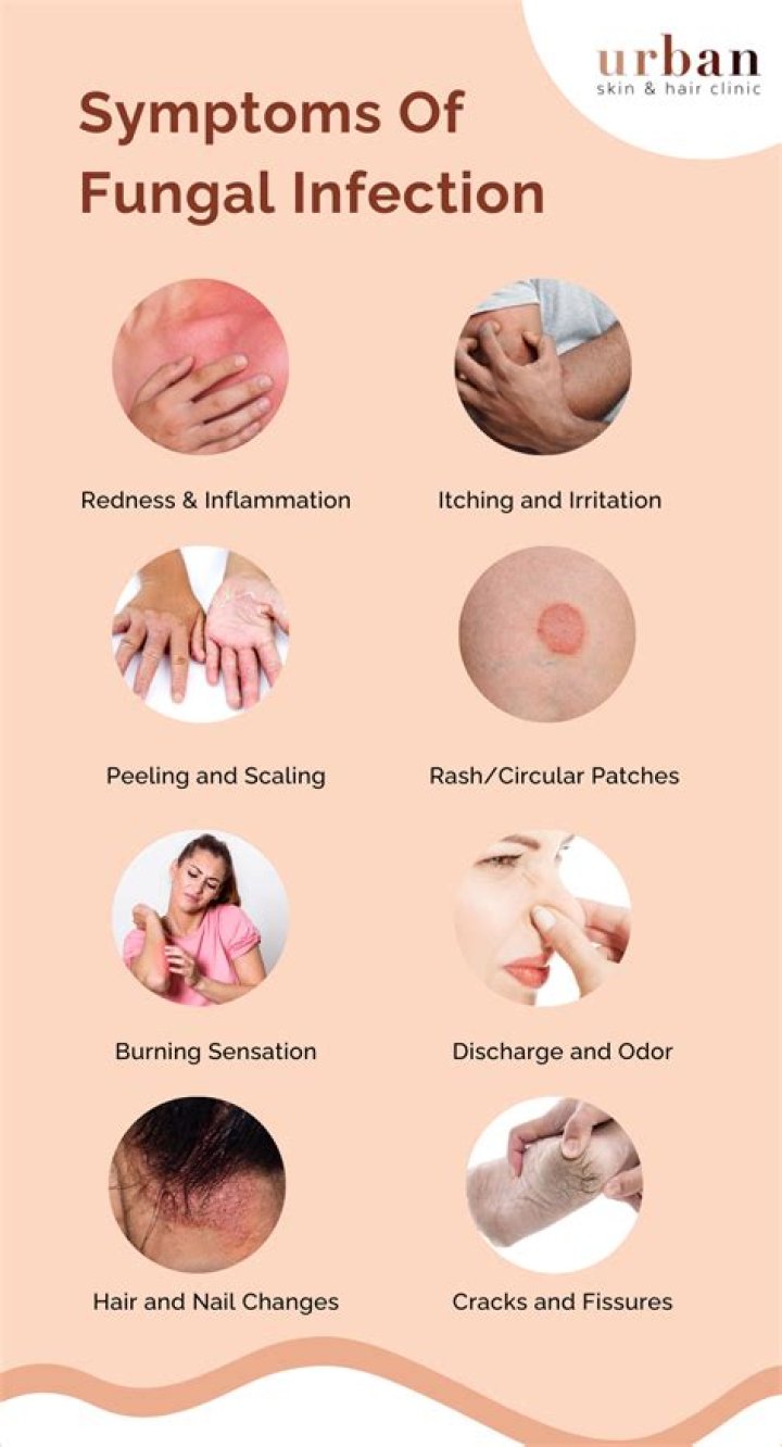 How do I know if I have a fungal ball?