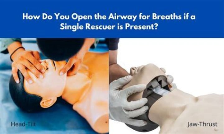 How do you open airways?