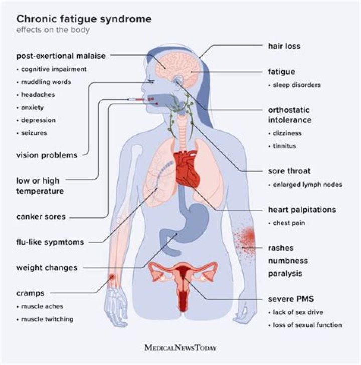 How long does a chronic fatigue flare up last?