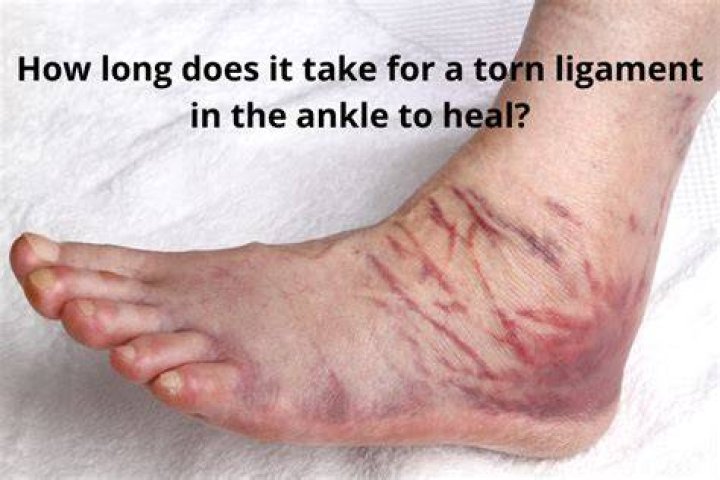 How long does it take for a torn ligament in the ankle to heal?