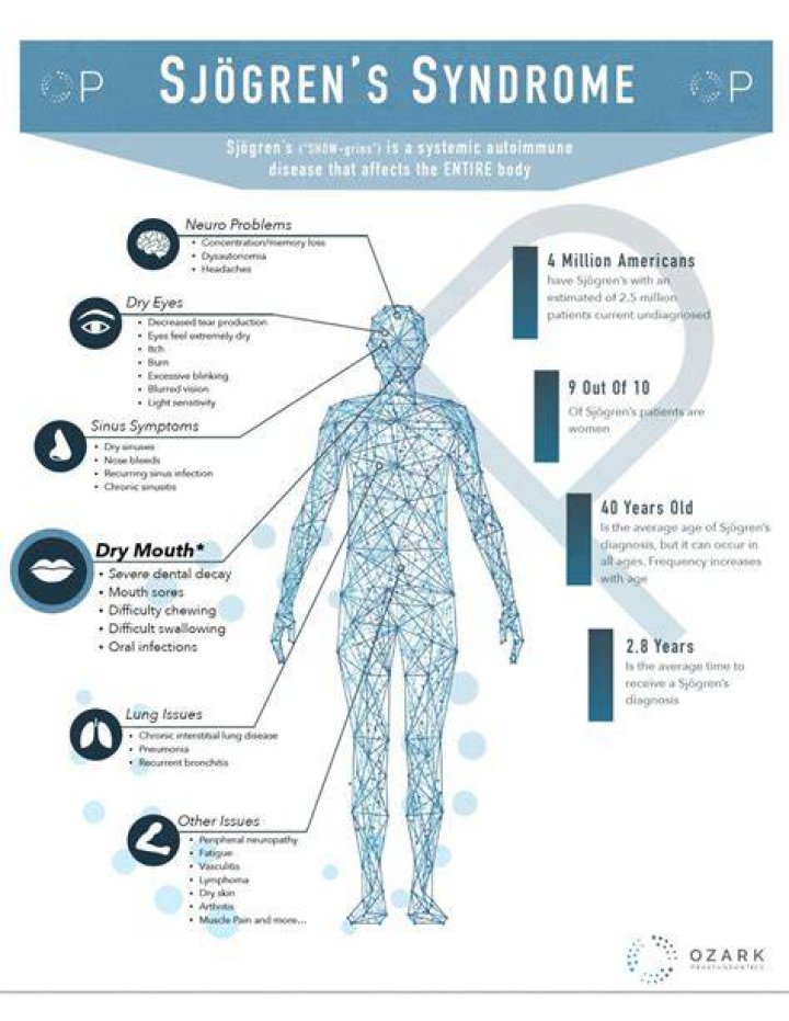 How serious is Sjogren's syndrome?