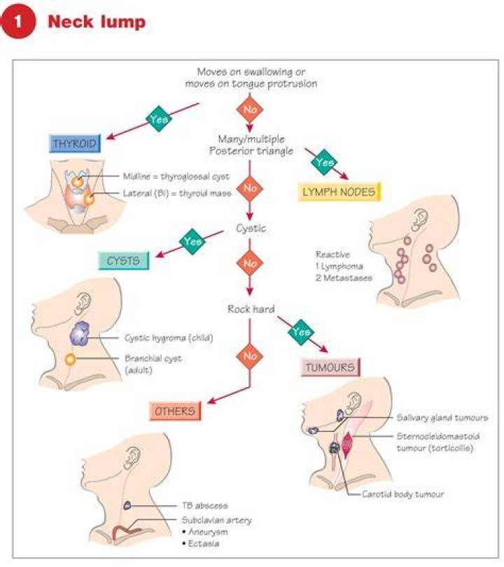 Is a pea-sized lump in neck normal?