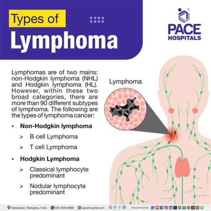 Is it hard to diagnose lymphoma?