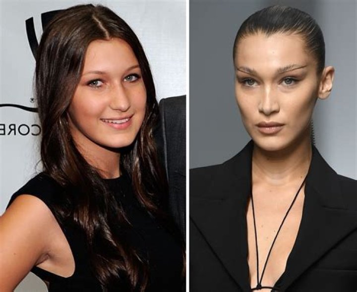 What deals did Bella Hadid lose?