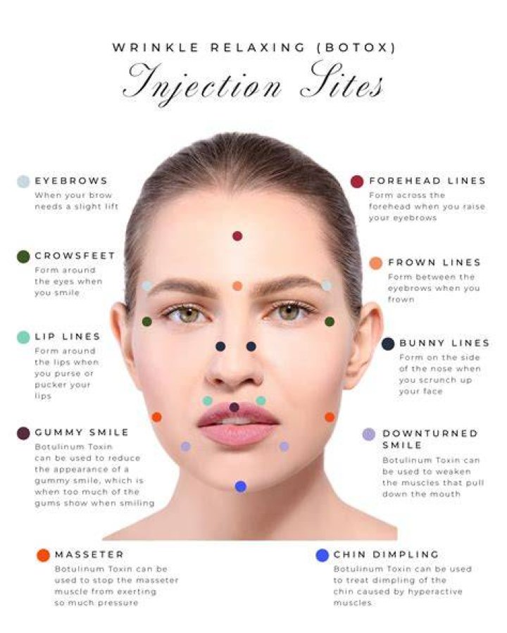 What happens to your face when you stop getting Botox?
