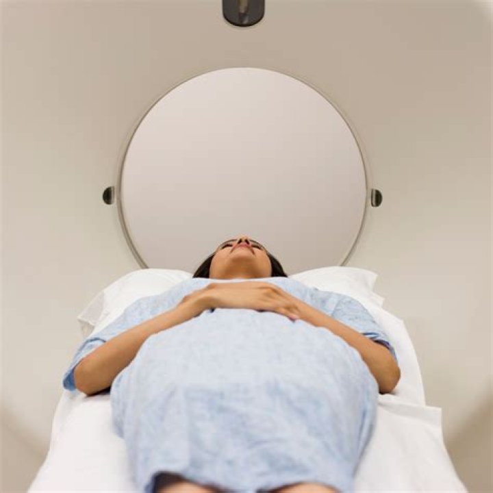 What if I can't get my rings off for an MRI?