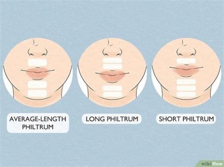 What is considered a long philtrum?