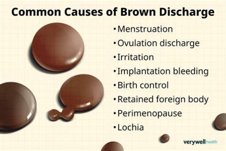 What STD causes brown discharge?