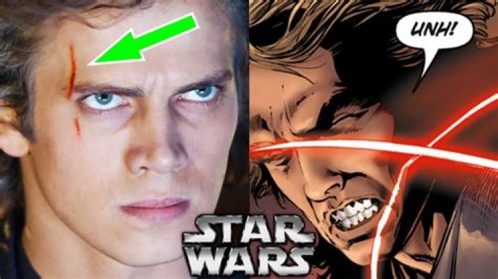 Where does Anakin get his scar?