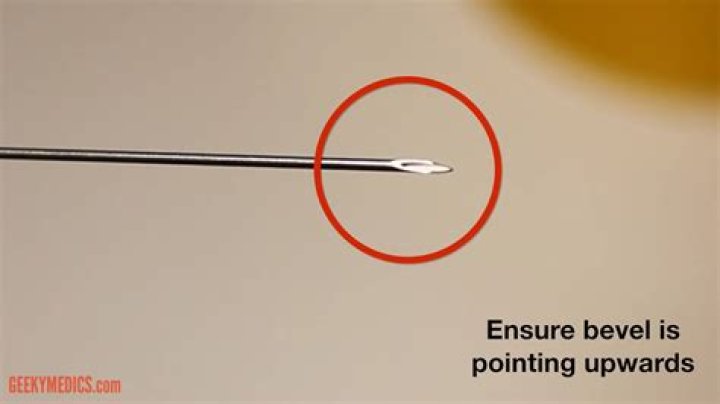 Where is the bevel on a needle?
