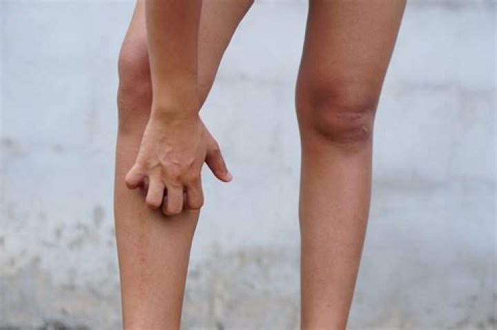Why are my lower legs itchy?