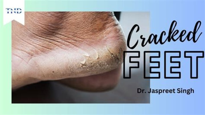 Why do chiropractors crack toes?