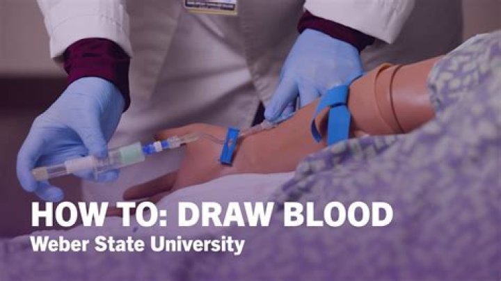 Why do they draw blood during labor?