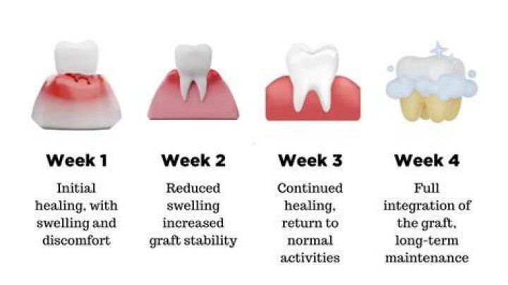 Why does my gum graft smell?