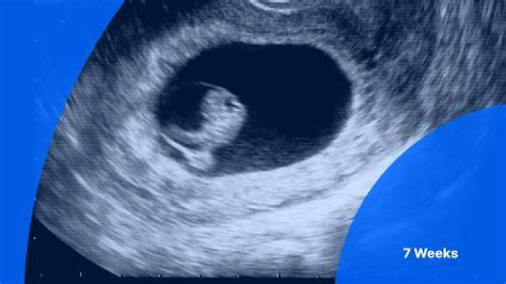 Why is there no heartbeat at 7 weeks?